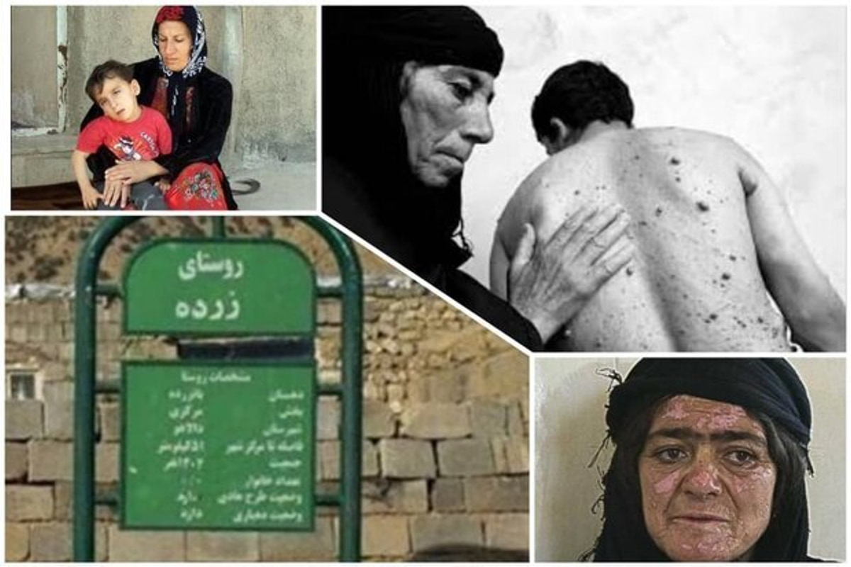 نفس‌های مسموم در هیروشیمای ایران؛ زرده در انتظار التیام زخم‌های کهنه